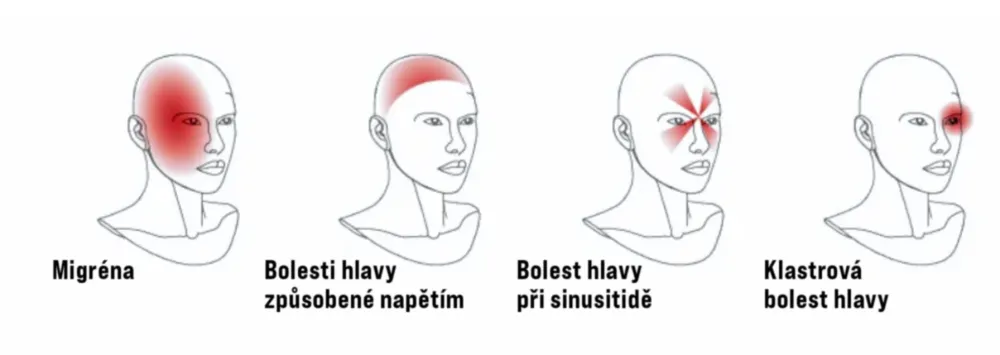 Headache types killing your neck C SM CS (1)